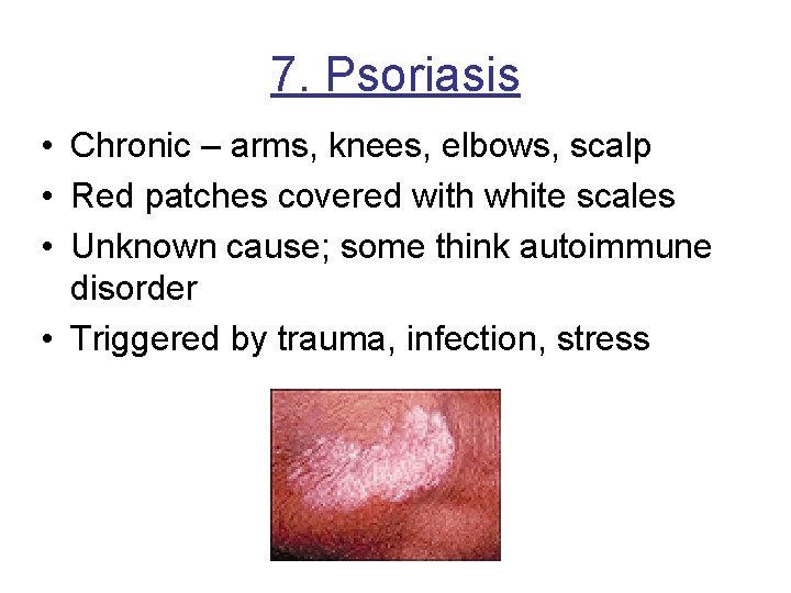 7. Psoriasis • Chronic – arms, knees, elbows, scalp • Red patches covered with