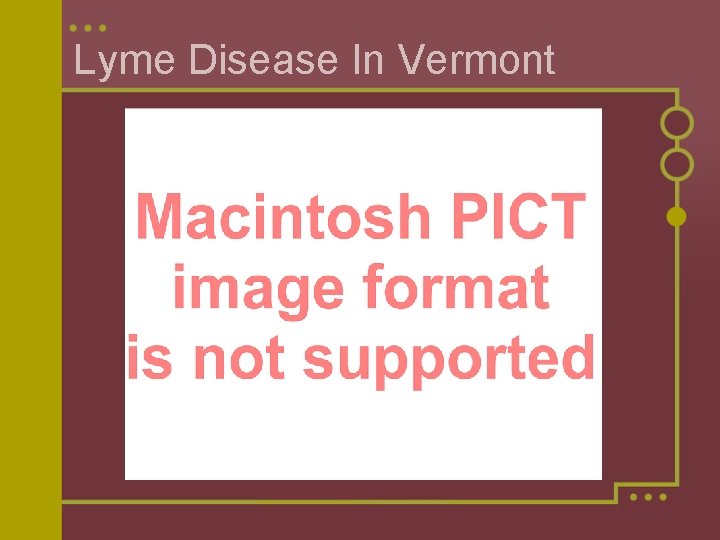 Lyme Disease In Vermont 