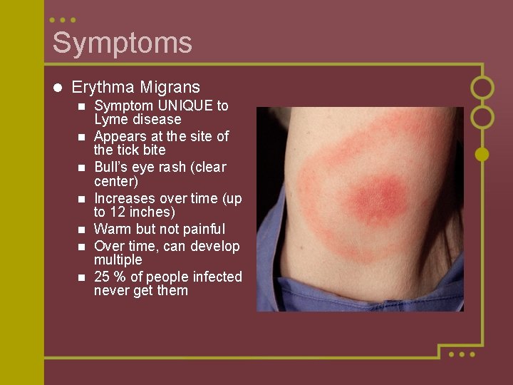 Symptoms l Erythma Migrans n n n n Symptom UNIQUE to Lyme disease Appears