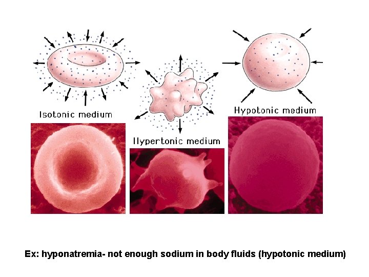 Ex: hyponatremia- not enough sodium in body fluids (hypotonic medium) 
