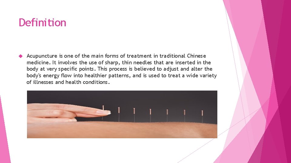 Definition Acupuncture is one of the main forms of treatment in traditional Chinese medicine.