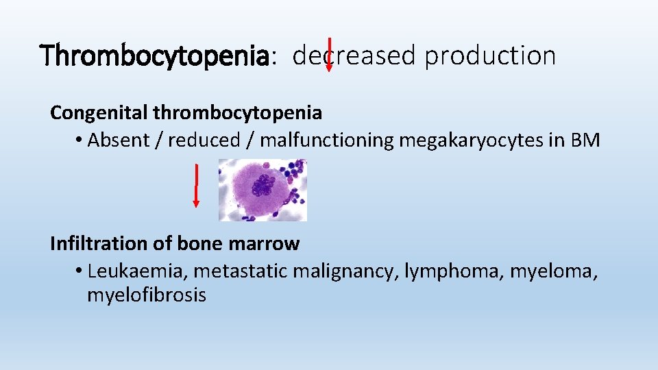 Thrombocytopenia: decreased production Congenital thrombocytopenia • Absent / reduced / malfunctioning megakaryocytes in BM