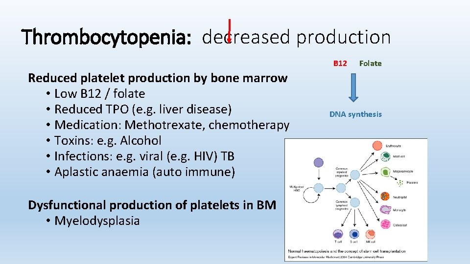 Thrombocytopenia: decreased production B 12 Reduced platelet production by bone marrow • Low B