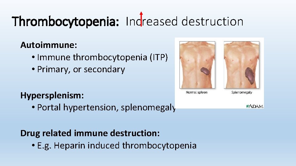Thrombocytopenia: Increased destruction Autoimmune: • Immune thrombocytopenia (ITP) • Primary, or secondary Hypersplenism: •