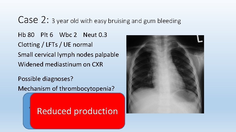 Case 2: 3 year old with easy bruising and gum bleeding Hb 80 Plt