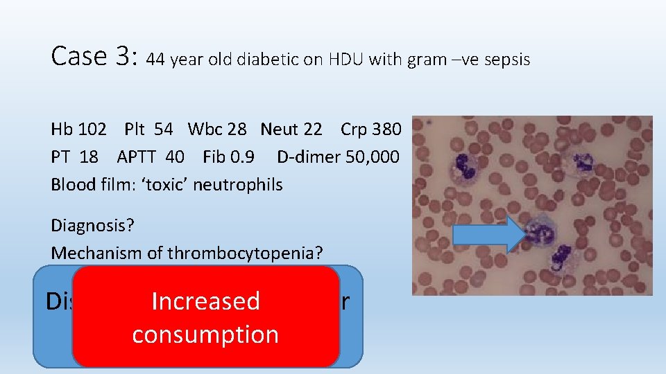 Case 3: 44 year old diabetic on HDU with gram –ve sepsis Hb 102
