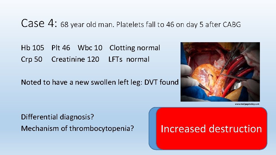 Case 4: 68 year old man. Platelets fall to 46 on day 5 after