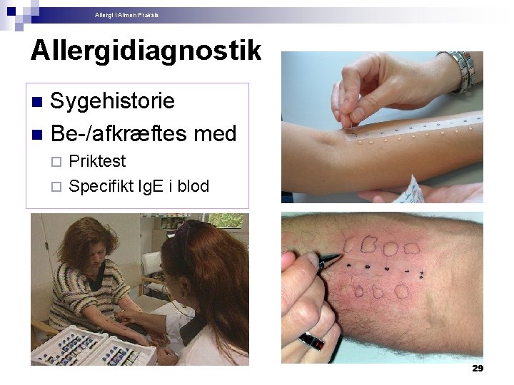 Allergi i Almen Praksis Allergidiagnostik Sygehistorie n Be-/afkræftes med n Priktest ¨ Specifikt Ig.