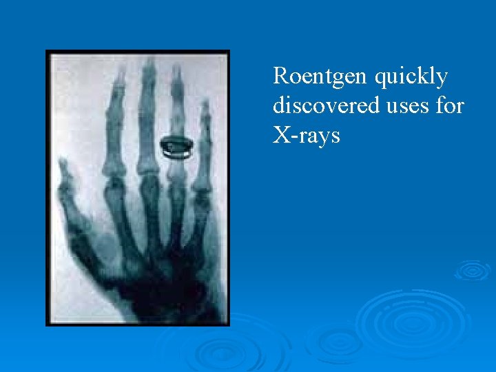 Roentgen quickly discovered uses for X-rays Roentgen quickly discovered uses for X-rays
