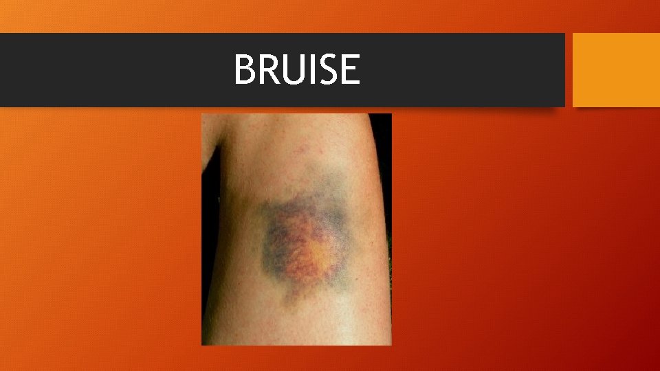 BRUISE 