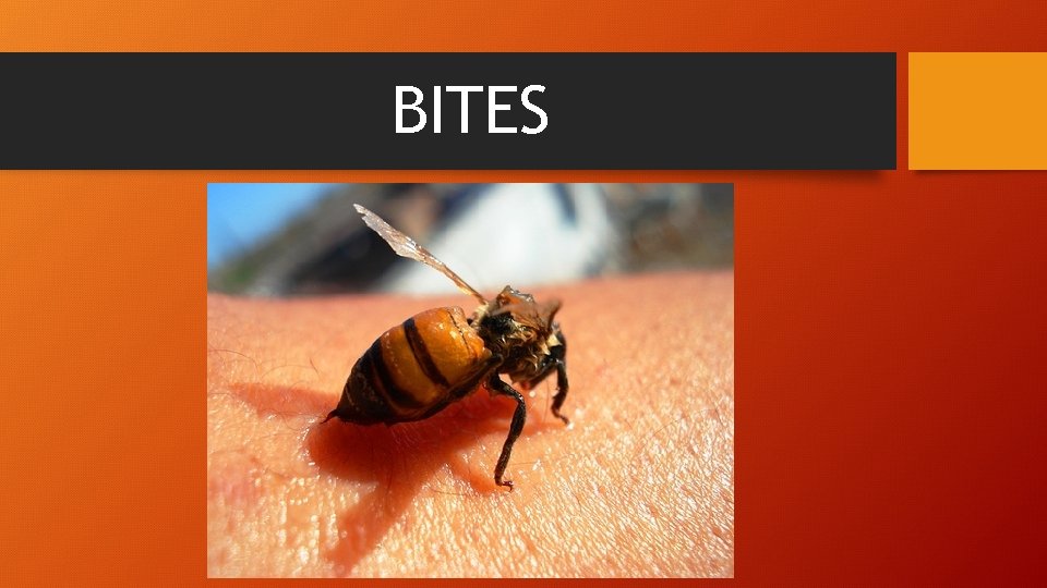 BITES 