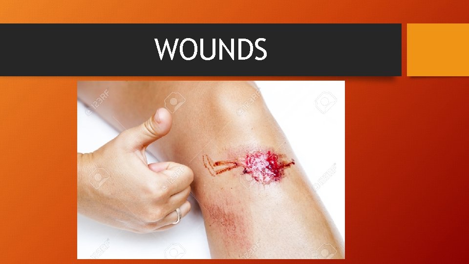 WOUNDS 