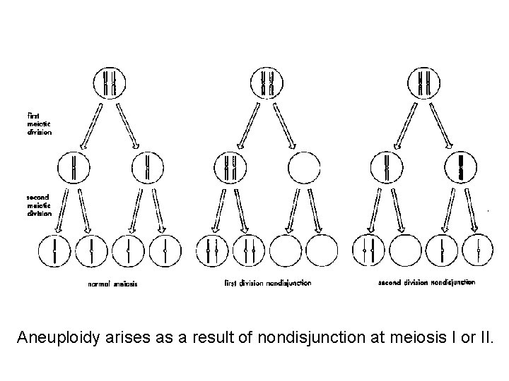 Aneuploidy arises as a result of nondisjunction at meiosis I or II. 