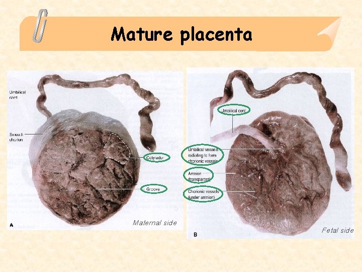 Mature placenta Maternal side Fetal side 