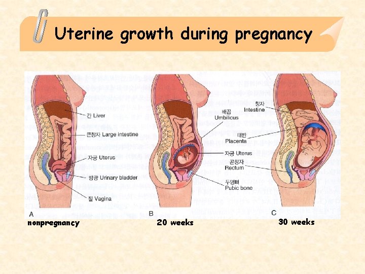 Uterine growth during pregnancy nonpregnancy 20 weeks 30 weeks 