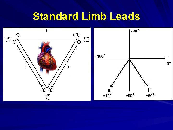 Standard Limb Leads 