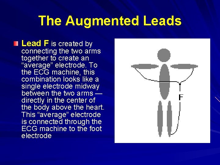 The Augmented Leads Lead F is created by connecting the two arms together to