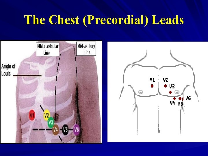 The Chest (Precordial) Leads 
