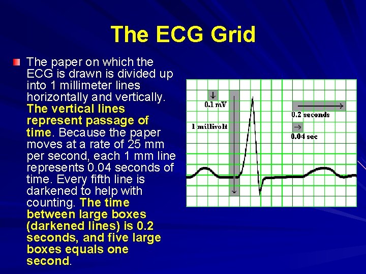 The ECG Grid The paper on which the ECG is drawn is divided up