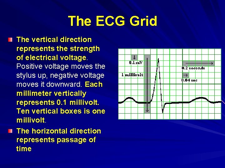 The ECG Grid The vertical direction represents the strength of electrical voltage. Positive voltage