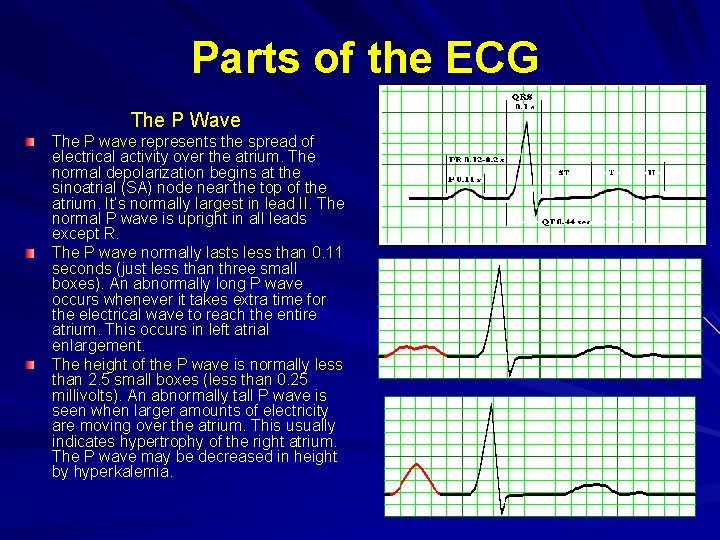 Parts of the ECG The P Wave The P wave represents the spread of