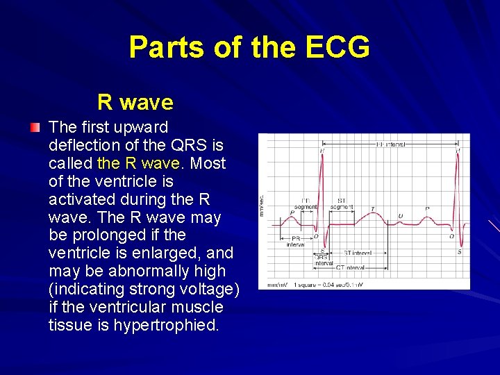 Parts of the ECG R wave The first upward deflection of the QRS is