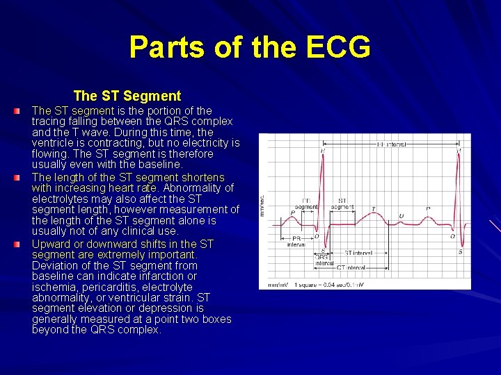 Parts of the ECG The ST Segment The ST segment is the portion of