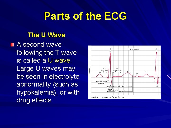 Parts of the ECG The U Wave A second wave following the T wave