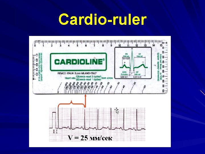 Cardio-ruler 