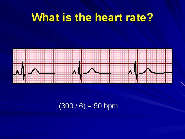 What is the heart rate? (300 / 6) = 50 bpm 