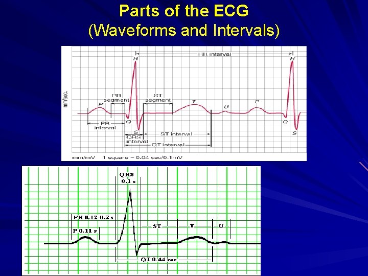 Parts of the ECG (Waveforms and Intervals) Parts of the ECG 