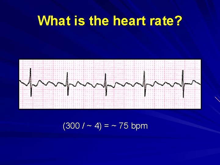What is the heart rate? (300 / ~ 4) = ~ 75 bpm 