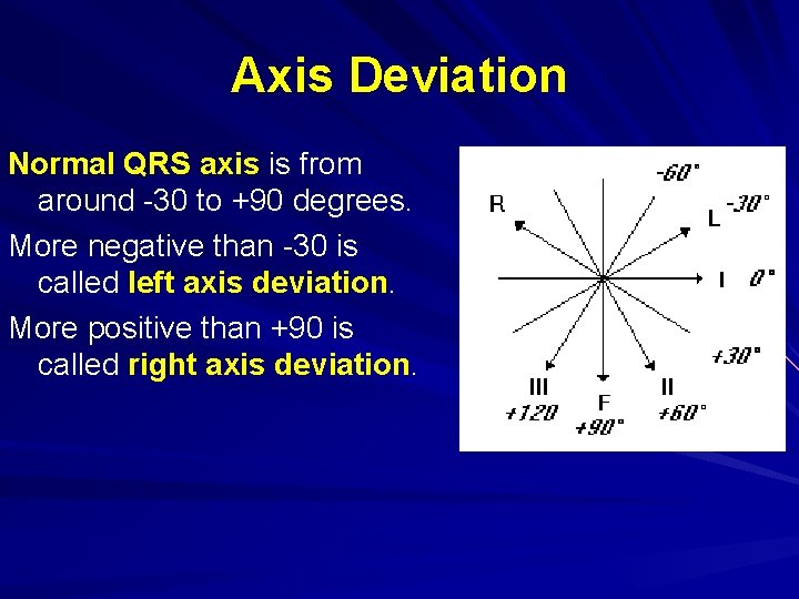 Axis Deviation Normal QRS axis is from around -30 to +90 degrees. More negative