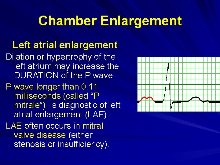 Chamber Enlargement Left atrial enlargement Dilation or hypertrophy of the left atrium may increase