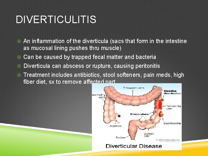 DIVERTICULITIS An inflammation of the diverticula (sacs that form in the intestine as mucosal