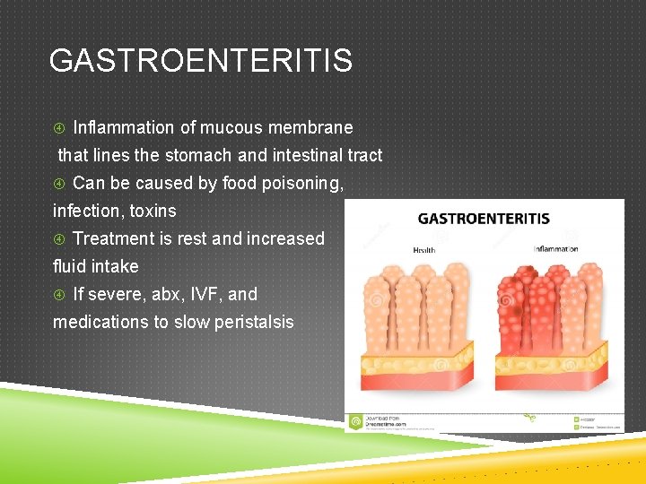 GASTROENTERITIS Inflammation of mucous membrane that lines the stomach and intestinal tract Can be