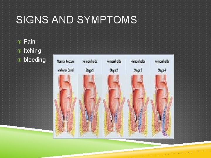 SIGNS AND SYMPTOMS Pain Itching bleeding 