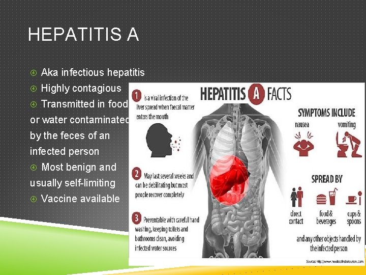 HEPATITIS A Aka infectious hepatitis Highly contagious Transmitted in food or water contaminated by