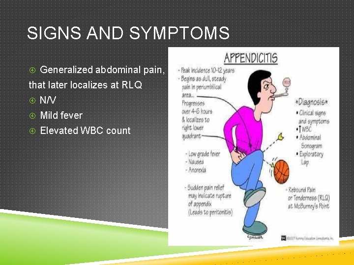 SIGNS AND SYMPTOMS Generalized abdominal pain, that later localizes at RLQ N/V Mild fever