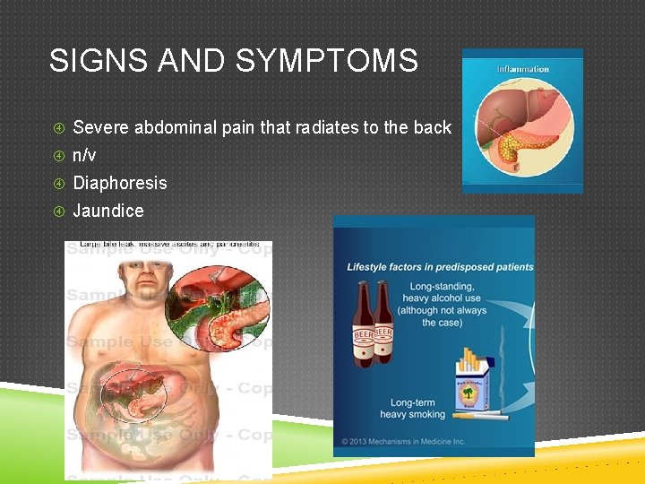 SIGNS AND SYMPTOMS Severe abdominal pain that radiates to the back n/v Diaphoresis Jaundice