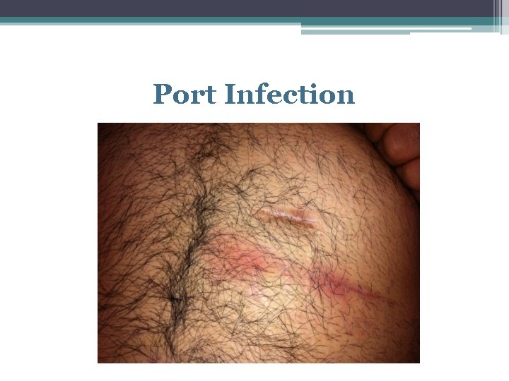 Port Infection 