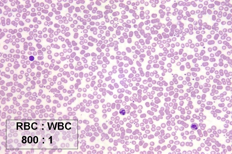 RBC : WBC 800 : 1 RBC : WBC 800 : 1