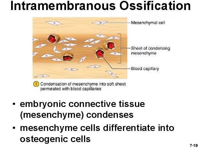 Intramembranous Ossification • embryonic connective tissue (mesenchyme) condenses • mesenchyme cells differentiate into osteogenic