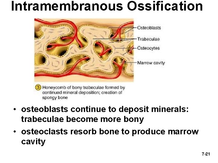 Intramembranous Ossification • osteoblasts continue to deposit minerals: trabeculae become more bony • osteoclasts