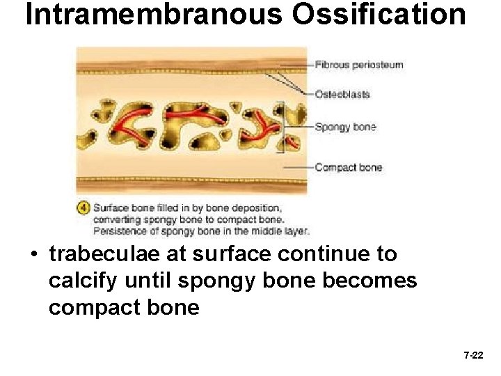 Intramembranous Ossification • trabeculae at surface continue to calcify until spongy bone becomes compact