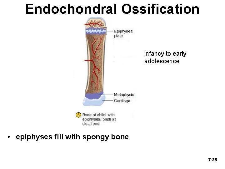Endochondral Ossification infancy to early adolescence • epiphyses fill with spongy bone 7 -28