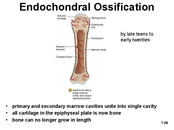 Endochondral Ossification by late teens to early twenties • primary and secondary marrow cavities