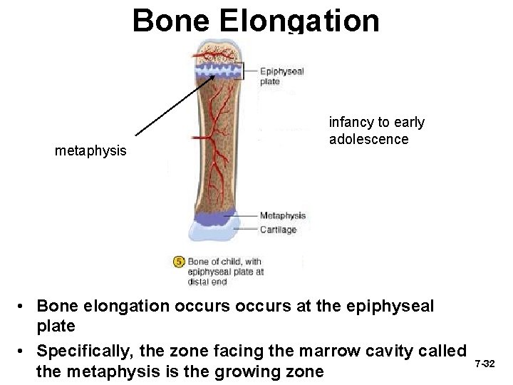 Bone Elongation metaphysis infancy to early adolescence • Bone elongation occurs at the epiphyseal