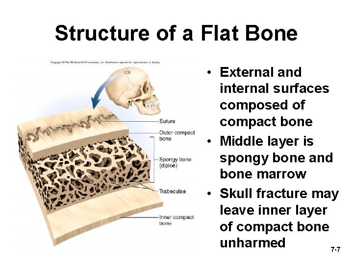 Structure of a Flat Bone • External and internal surfaces composed of compact bone