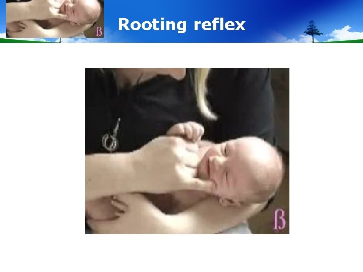 Rooting reflex 